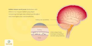 Sistem Saraf pada Manusia: Pengertian, Bagian dan Gangguannya 11 Sistem Saraf pada Manusia: Pengertian, Bagian dan Gangguannya 9